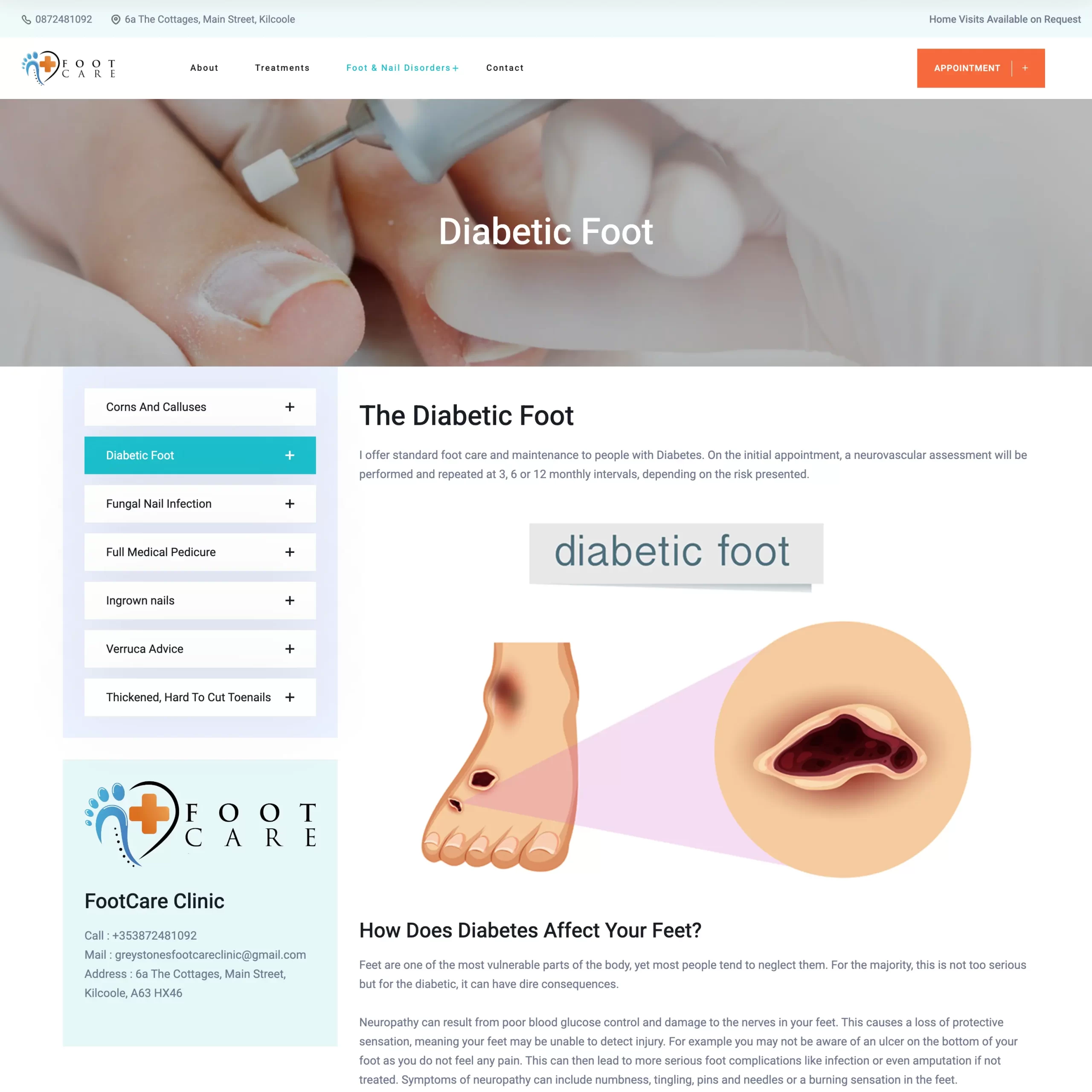 Diabetic Foot – The Foot Care Clinic